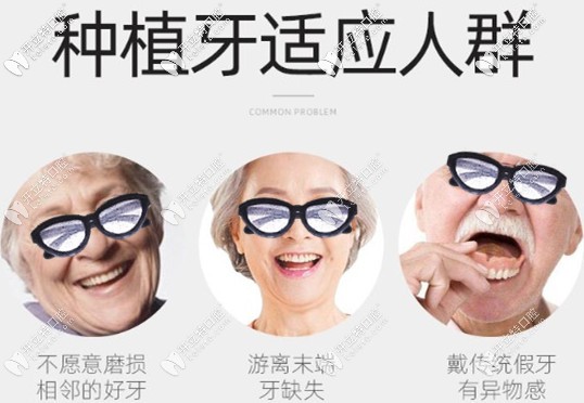 种植牙的适应人群