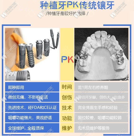 种植牙和传统假牙哪个好 种植牙和传统假牙哪个好