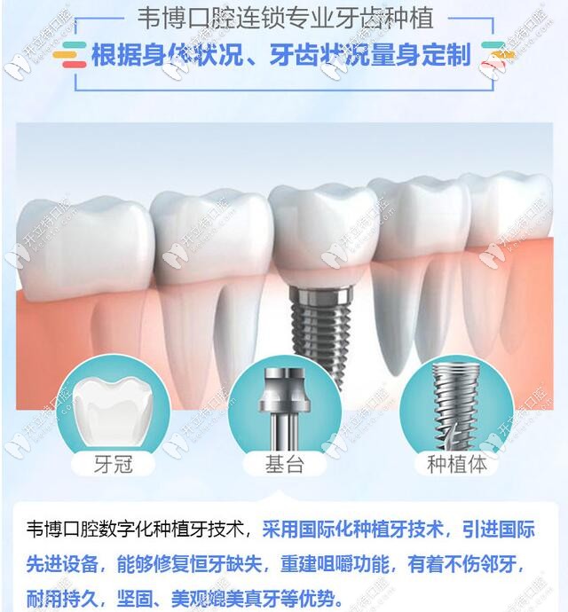 深圳韦博口腔种植牙更专业