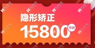 隐形矫正15800元起