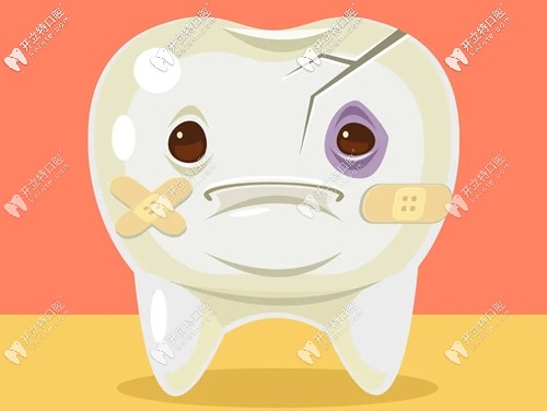 王龙波浅谈根管治疗后的牙齿为何要戴牙冠