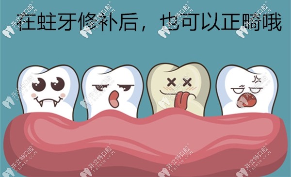 蛀牙颗数超过20颗可能就正畸无望了 蛀牙颗数超过20颗可能就正畸无望了