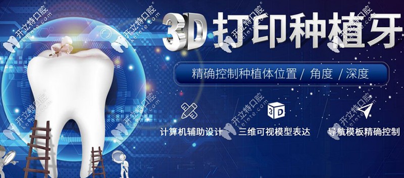 3D打印种植技术