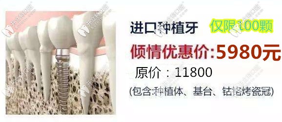 请看在济南做韩国奥齿泰种植牙多少钱一颗