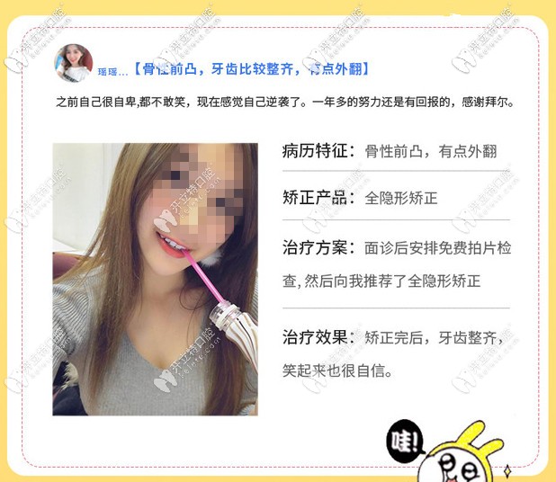 隐形矫正案例