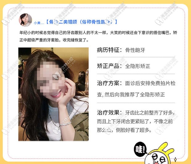 骨性龅牙矫正案例