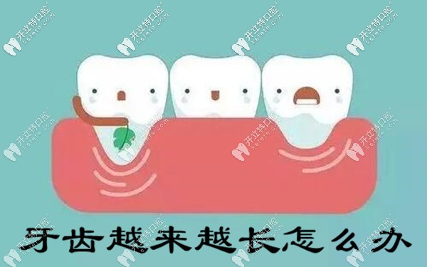 牙医告诉你：牙齿越来越长怎么办（附预防方法）