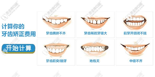 牙齿矫正的不同情况