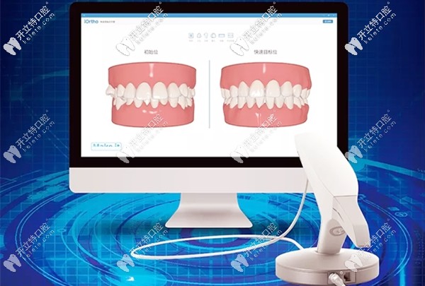 时代天使3shape 3D口扫仪 时代天使3shape 3D口扫仪