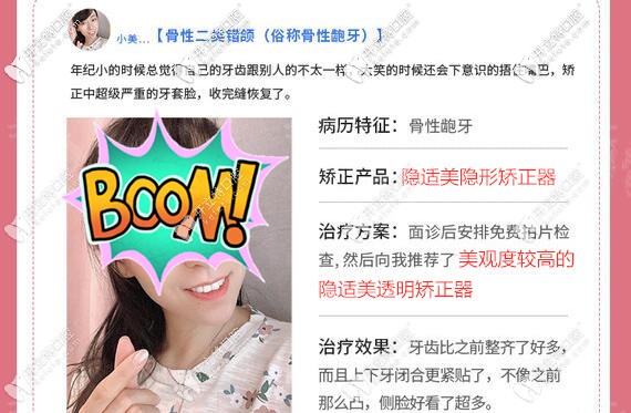深圳拜尔口腔隐形矫正案例 深圳拜尔口腔隐形矫正案例