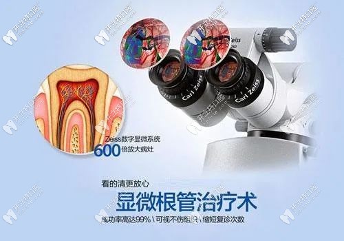 显微镜跟管治疗的优势 显微镜跟管治疗的优势