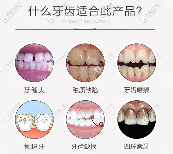 适合做EMAX瓷贴面的牙齿情况