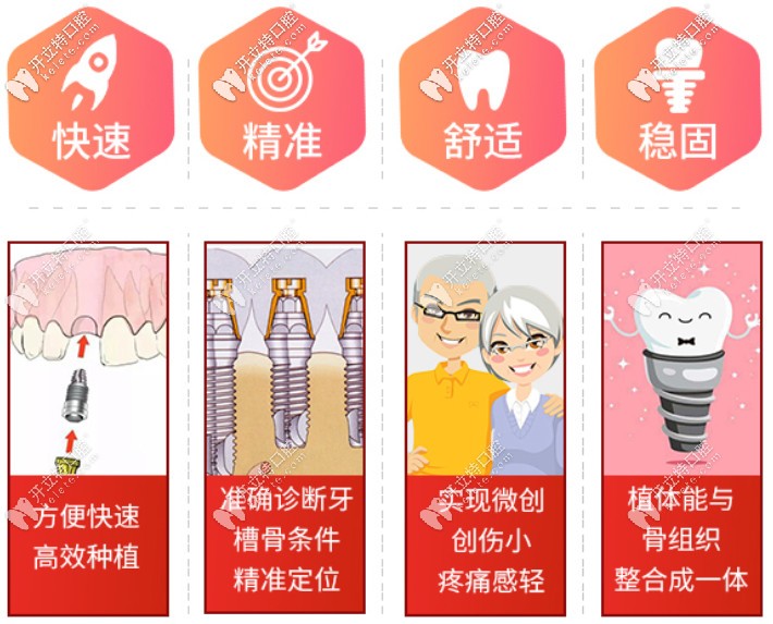 北京西尔口腔种植牙技术优势