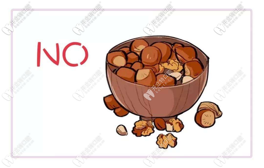 坚果类食物要避免吃 坚果类食物要避免吃