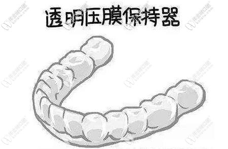 保持器要按时佩戴 保持器要按时佩戴