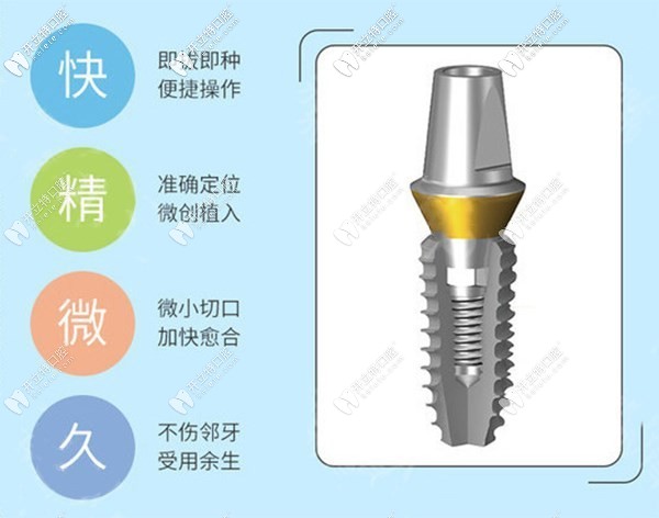美国皓圣种植体2500元一颗靠谱吗?中端档次+质保5年+寿命20年