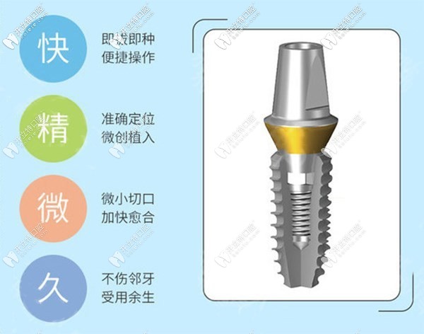 美国皓圣种植牙价格才4500元/颗，看完优势和寿命我种了