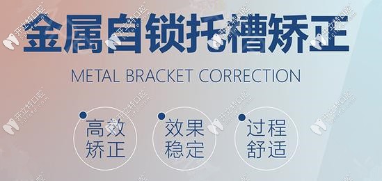 金属自锁托槽矫正优势