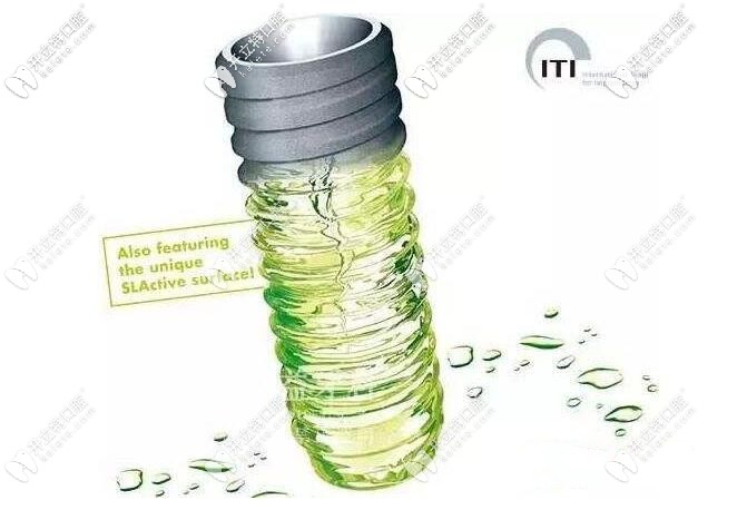 瑞士ITI种植牙系统优势