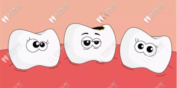 龋齿就要早发现早解决