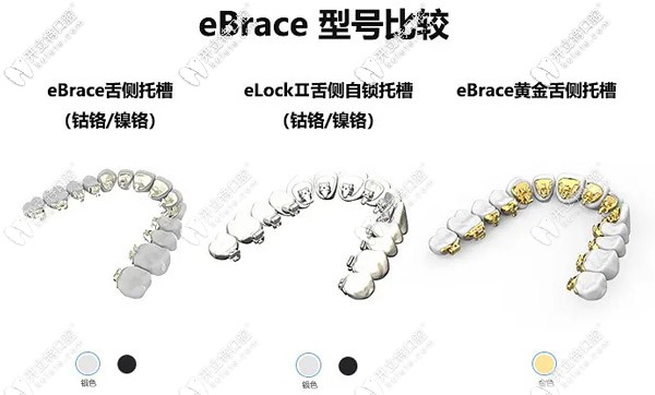 国产Ebrace舌侧矫正起器型号对比