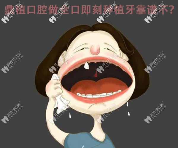 谁做过即刻种植牙啊,在上海鼎植口腔做这种全口的靠谱不