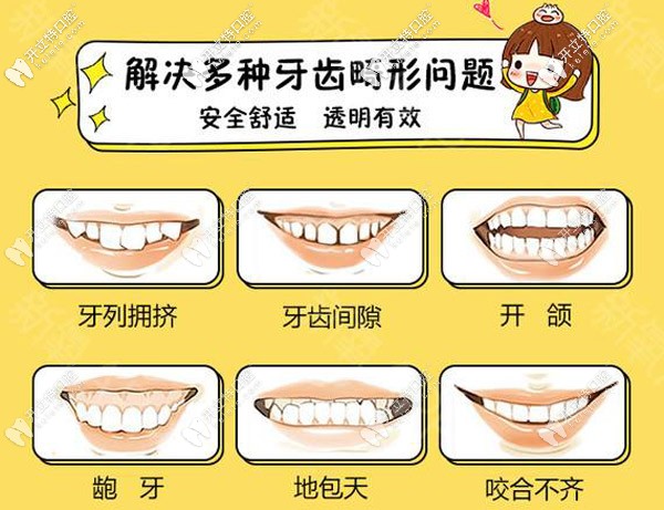 多种牙齿畸形的情况可通过矫正解决