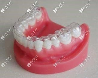 牙齿保持器