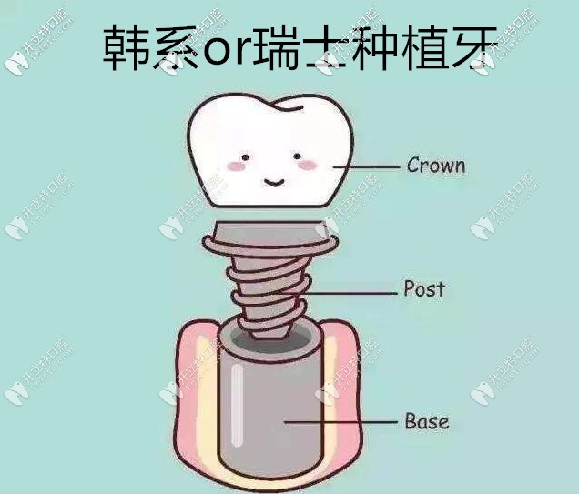 韩系和瑞士的价格差多少