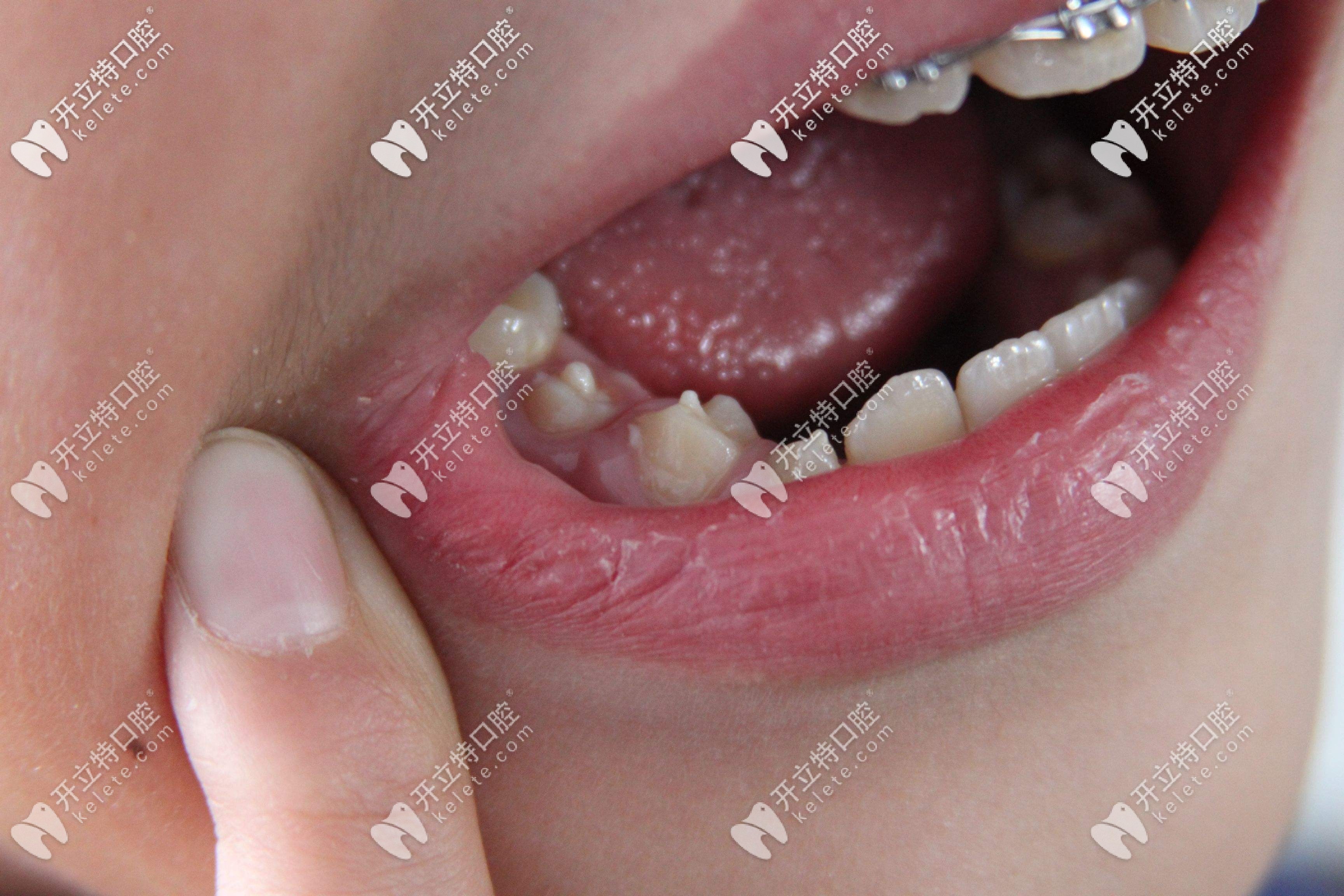 谁知道北京私立儿童口腔哪个好?能给孩子矫正牙齿的那种？