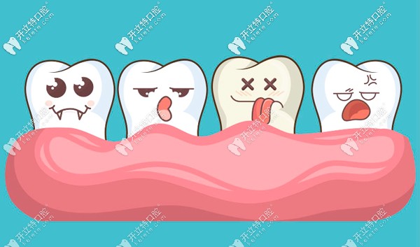 如何评判做牙齿贴面效果的优劣呢？
