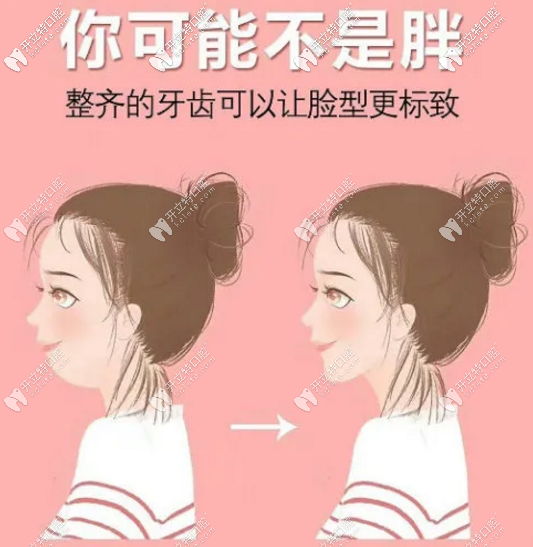 你是不是想改变脸型