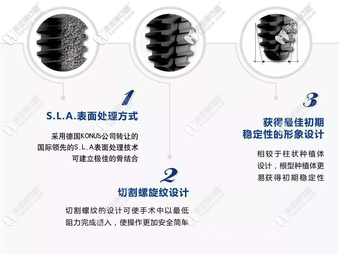 韩国仕诺康种植牙的优势