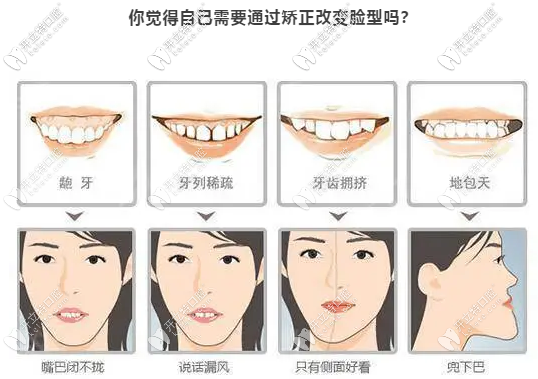 看看自己需要通过整牙来改变脸型吗