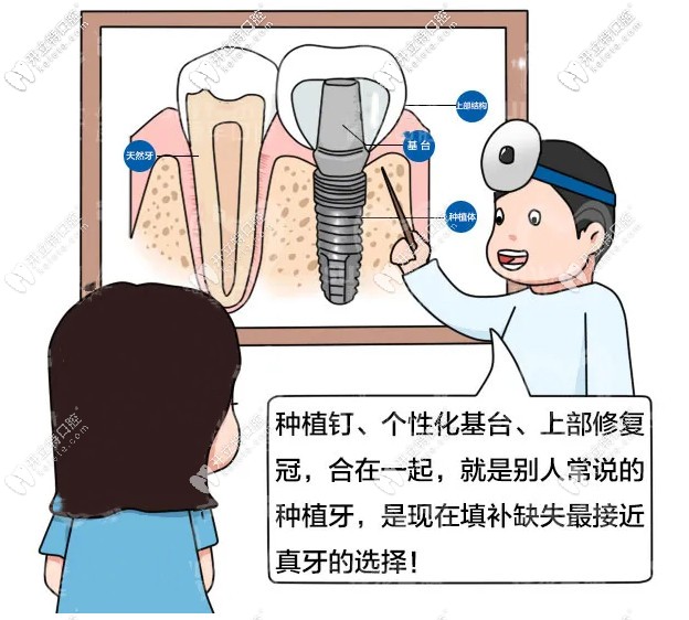 在广州穗华口腔做1颗诺贝尔种植牙多少钱?过程疼不疼呢！