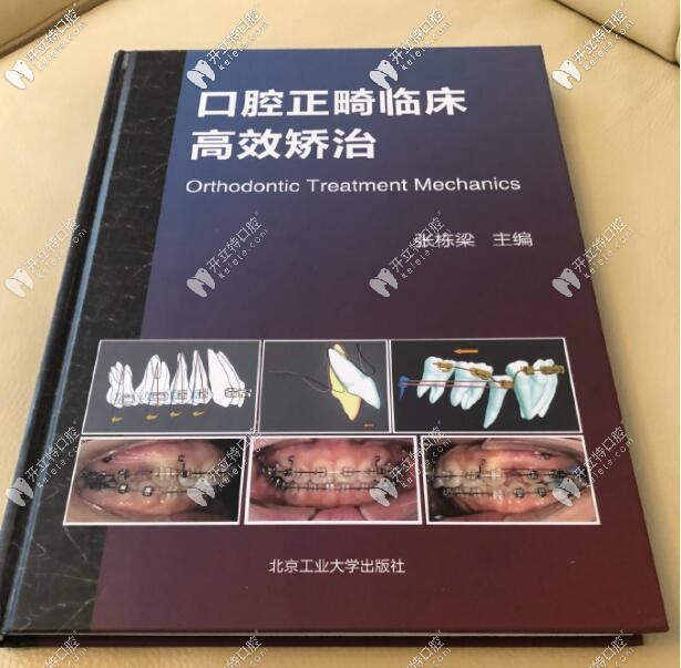张栋梁出版的正畸书籍之一 张栋梁出版的正畸书籍之一