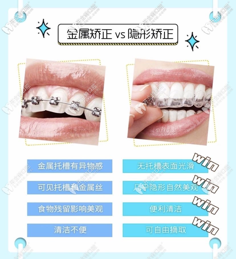 金属牙套与隐形牙套对比 金属牙套与隐形牙套对比