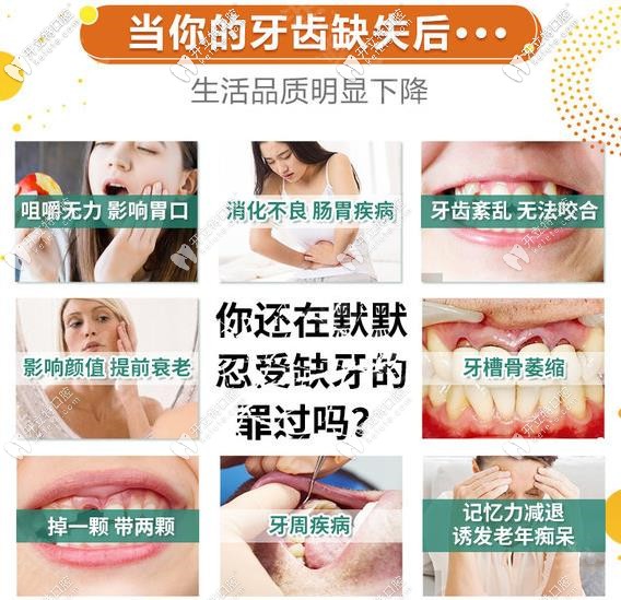 缺牙危害不能拖要及时医治 缺牙危害不能拖要及时医治