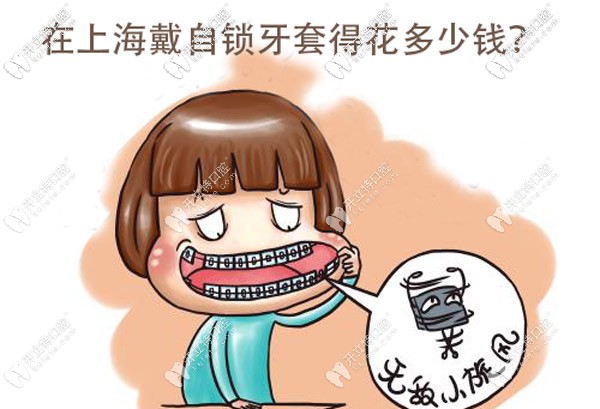 目前在上海戴金属自锁牙套的价格大概是多少？
