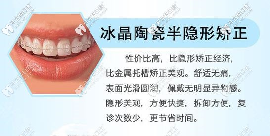 半隐形陶瓷牙齿矫正器优势