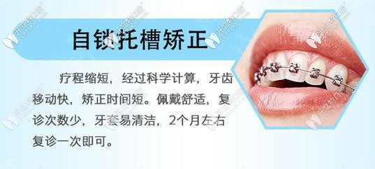金属自锁牙套矫正器优势