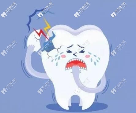 牙齿修复都包括哪些