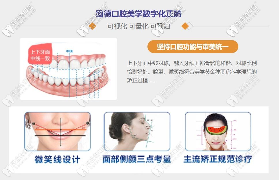 固德口腔数字化正畸图示