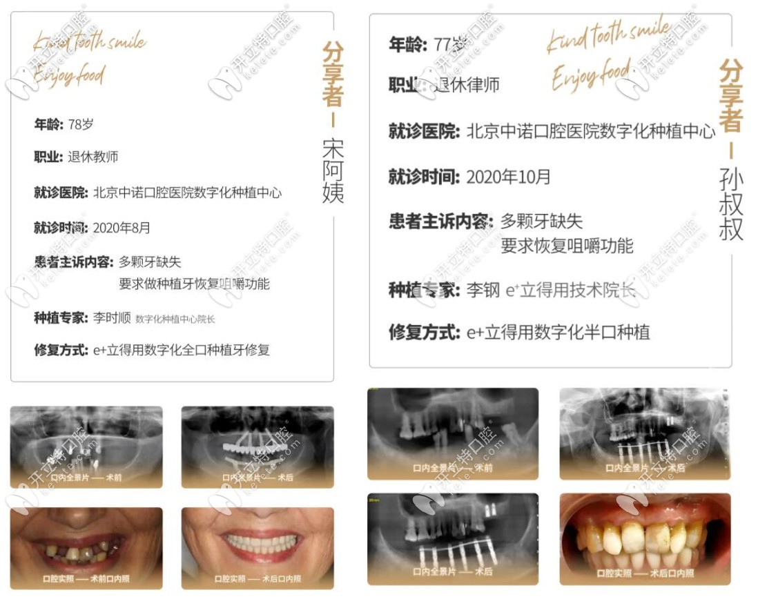 在中诺做半口种植牙和全口种植牙的老人的真实<span style=