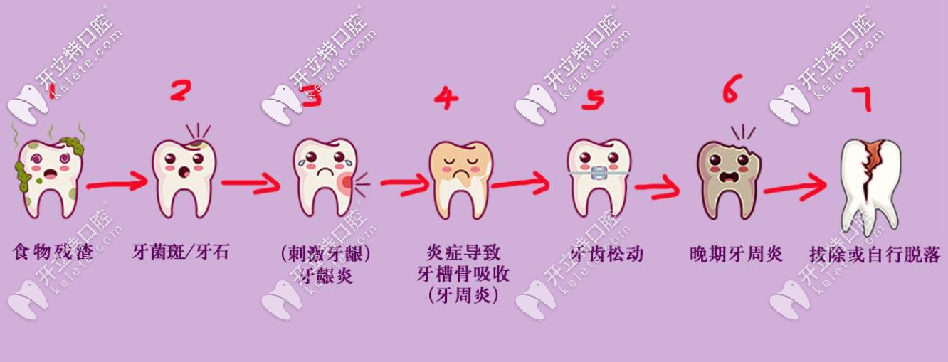 牙齿掉落的过程 牙齿掉落的过程
