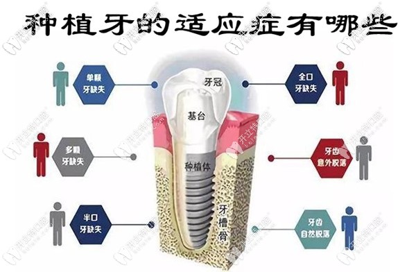 QQ截图20201202152432_副本.jpg
