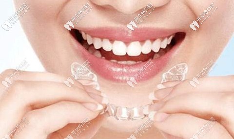 隐形牙套