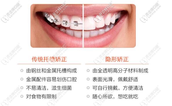 传统矫正和隐形矫正的区别 传统矫正和隐形矫正的区别