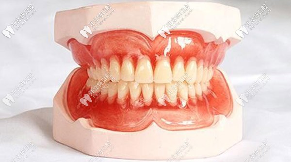 常用的BPS吸附性义齿