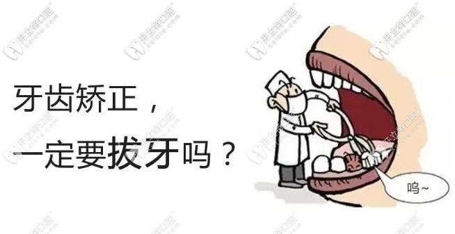 矫正不一定都要拔牙哦 矫正不一定都要拔牙哦